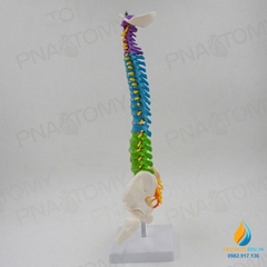 Mô hình giải phẫu cột xương sống uốn cong 45cm, đốt sống trật khớp