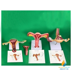 Mô hình âm đạo và tử cung người, chất liệu nhựa PVC, mô hình giảng dạy y khoa