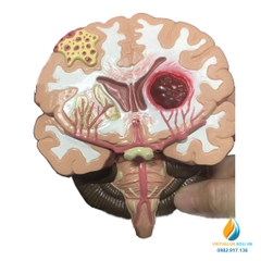 Mô hình bệnh lý não và cấu trúc, chất liệu nhựa PVC, mô hình y khoa
