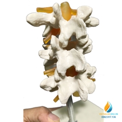 Mô hình đốt xương sống con người, chất liệu nhựa PVC, mô hình giảng dạy y khoa