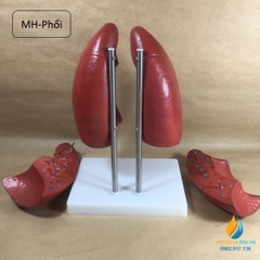 Mô hình hai lá phổi người có chân đế, mô hình giảng dạy giải phẫu học người