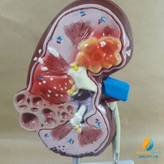 Tổng quan về hệ tiết niệu của cơ thể
