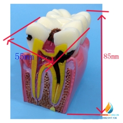 Mô hình cắt ngang của răng người, kích thước 55x75x85mm, chất liệu nhựa PVC