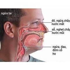 Nhỏ mũi đặc trị viêm xoang