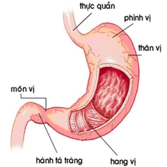 Triệu chứng bệnh dạ dày ? Đông y chữa bệnh đau dạ dày như thế nào?