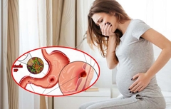 Đau dạ dày khi mang thai