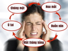 Một số cách chữa bệnh tiền đình không cần thuốc