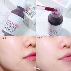 Serum tái tạo da sinh học Red Peel Tingle