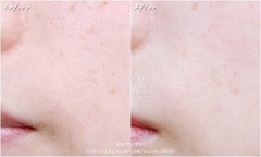 Mặt nạ collagen tươi Celderma Marine Collagen Hydrogen Mask