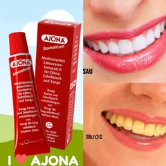 KEM ĐÁNH RĂNG AJONA