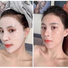 Mặt nạ Derm-All Matrix Mask Hàn Quốc (mẫu mới)