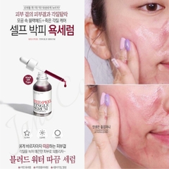 Serum tái tạo da sinh học Red Peel Tingle