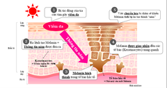 Transino hộp bạc - Viên uống trị nám tàn nhang, hàng nội địa Nhật