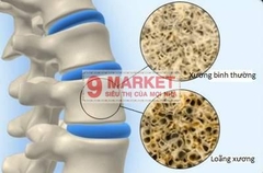 Canxi dạng kẹo Vitaffuntion 100V