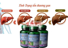 Viên hỗ trợ gan Milk Thistle 1000mg Puritan Pride 180V