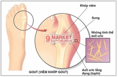 Viên uống trị Gout Anserine Minami Nhật Bản