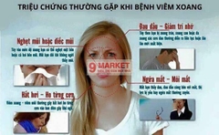 Thuốc xịt mũi Nazal - Nhật Bản