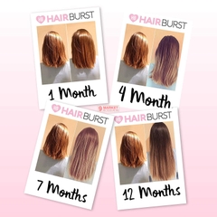 Hairburst - Viên uống hỗ trợ mọc tóc của Anh