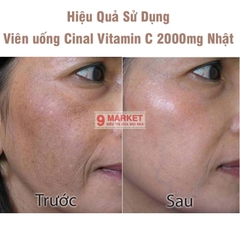 Viên Uống Trắng Da, Trị Mụn Cinal C Nhật Bản