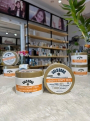 Kem Dưỡng Trị Thâm Mông, Nách, Bẹn Gold Bond Rough & Bumpy Skin Cream 226g