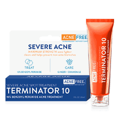Kem trị mụn bọc , mụn đầu đen , mụn thâm Terminator 10 AcneFree Acne & Blackhead