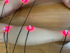 Máy laser châm cứu 12 kênh