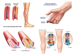 Hệ thống chuẩn đoán mạch máu ngoại biên và hệ thống thần kinh tự chủ