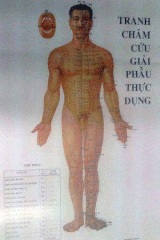 Tranh châm cứu giải phẫu thực dụng (12 tờ)