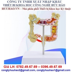 MÔ HÌNH GIẢNG DẠY KHÁM ĐẠI TRÀNG