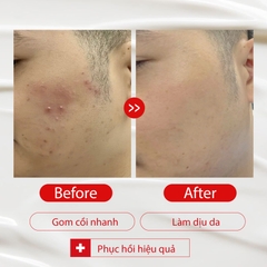 GEL DỊU DA DR.INNODERM AC ANTI SPOT