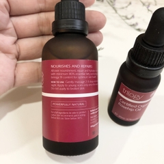 [Organic] Dầu tầm xuân hữu cơ Trilogy Rose Hip Oil