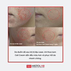Kem dưỡng phục hồi da B5 EGF Histolab Cell Cream