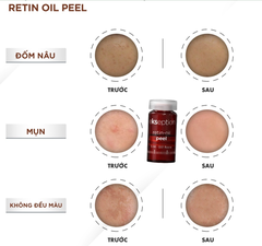 Peel Retin-oil Ekseption căng bóng, trẻ hóa da, khô cồi mụn, đều màu da