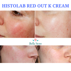 Kem dưỡng chống mẩn đỏ, kích ứng da Histolab K Cream Red Out