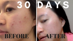 Mặt nạ đất sét Aztec Secret Healing Clay