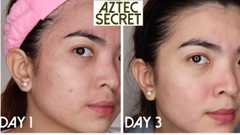 Mặt nạ đất sét Aztec Secret Healing Clay
