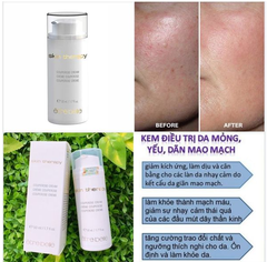 Kem phục hồi mao mạch, da nhiễm corticoid Être Belle Couperose hàng Đức