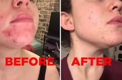Mặt nạ đất sét Aztec Secret Healing Clay