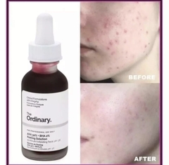 Serum tẩy da chết, tái tạo da The Ordinary AHA 30% + BHA 2% Peeling Solution