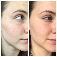 [BHA] Sữa rửa mặt trị mụn Mario Badescu Acne Facial Cleanser