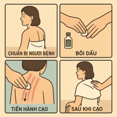 Giúp tôi giải thích và hướng dẫn về việc cạo gió, đánh cảm bằng đồng bạc, thìa bạc ?