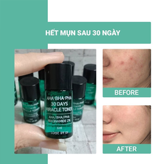 Nước Hoa Hồng Giảm Mụn Dưỡng Ẩm Some By Mi AHA-BHA-PHA 30 Days Miracle Toner 6ml -  TRIALSIZE