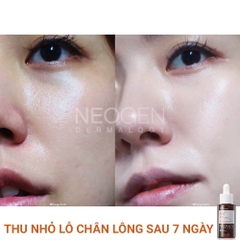 Siêu Tinh Chất Mờ Thâm Dưỡng Trắng Vitamin C SAP Neogen Dermalogy Real Vita C Serum 32g