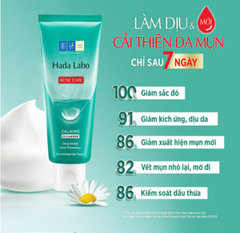 Kem Rửa Mặt Hada Labo Acne Care Calming Cleanser, Sửa Rửa Mặt Cho Da Mụn Và Nhạy Cảm 80g