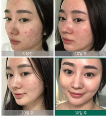 Nước Hoa Hồng Giảm Và Ngăn Ngừa Mụn Some By Mi AHA-BHA-PHA 30 Days Miracle Toner 150ml