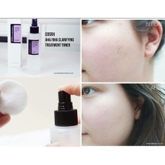 Nước Hoa Hồng COSRX Chứa AHA / BHA Tẩy Tế Bào Chết Làm Sáng Da Giảm Mụn 150ml