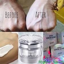 SET KEM ỐC SÊN DƯỠNG TRẮNG DA PREMIUM SNAIL TONE UP CREAM