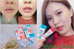 SON DƯỠNG TRỊ THÂM MÔI LIP CARE LABOCARESON