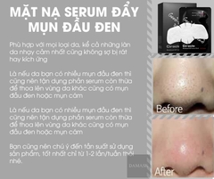 Review Serum Đẩy Mụn Đầu Đen Goodbye Blackhead