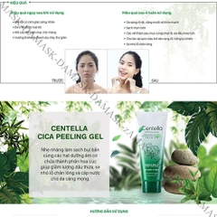 Tẩy da chết tái tạo phục hồi da Beauskin Centella Cica Hàn Quốc